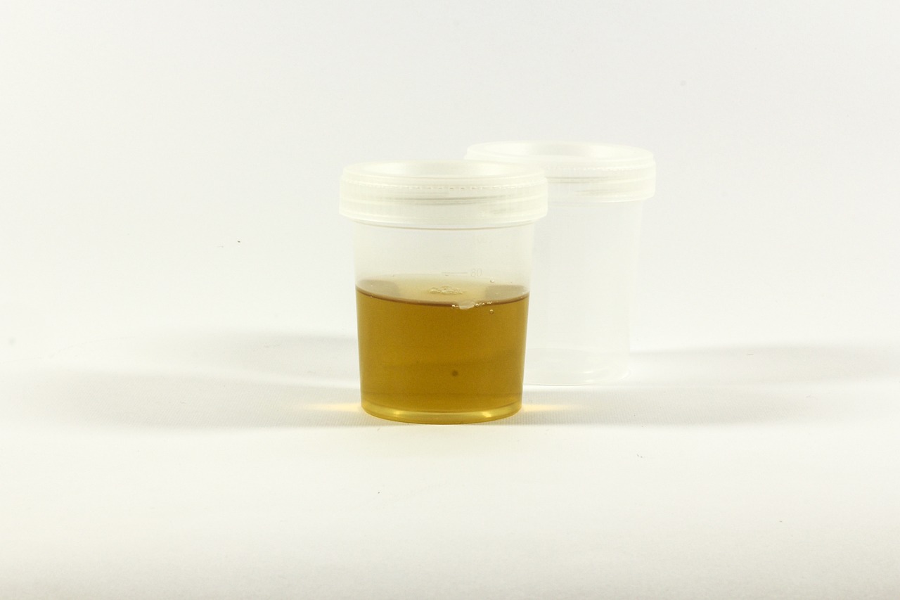 test urine with paper against cancers